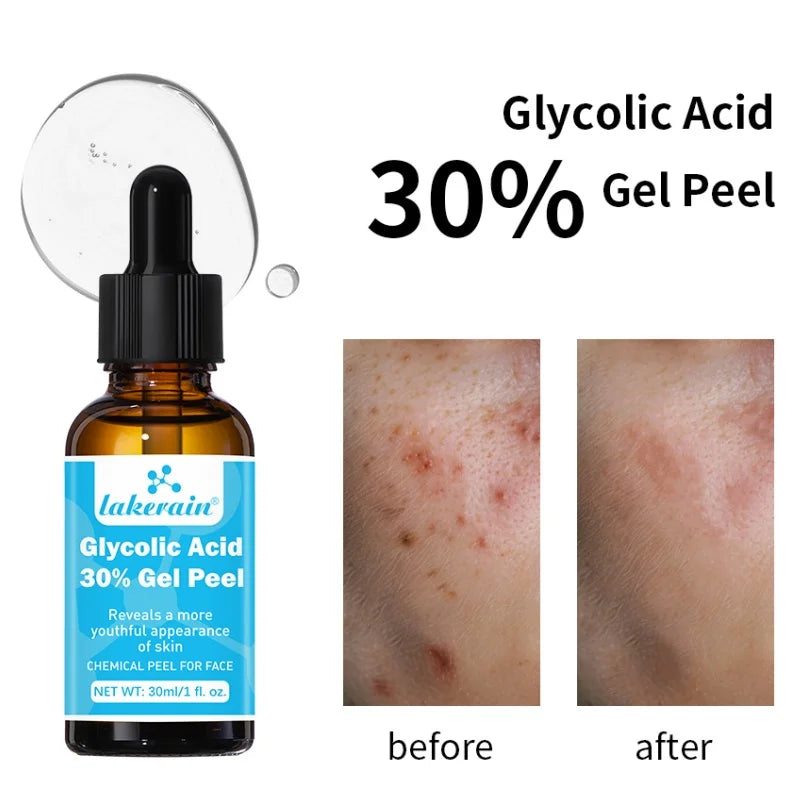ORFAOM Glycolic Acid 30% Professional Skin Peel