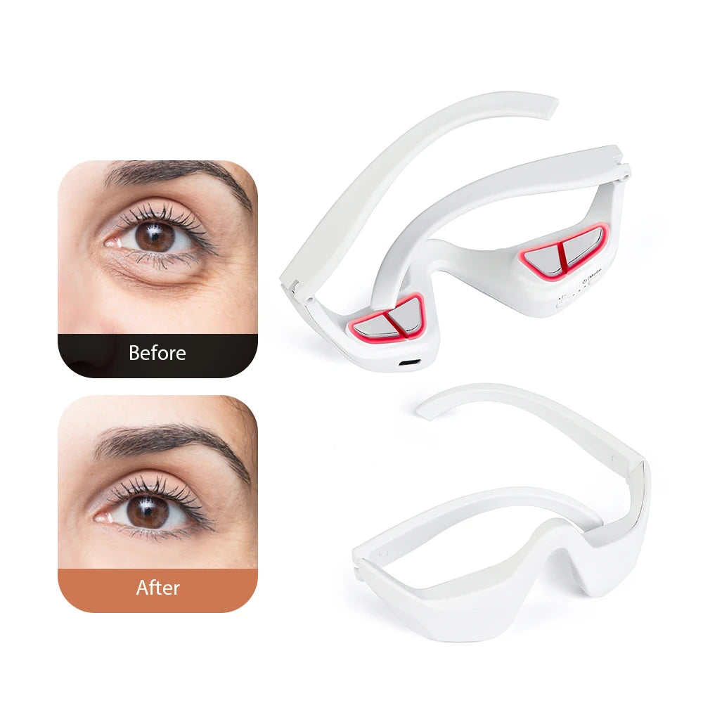 ORFAOM LED Eye Therapy Massager – Red Light Relax & De-Puff Device